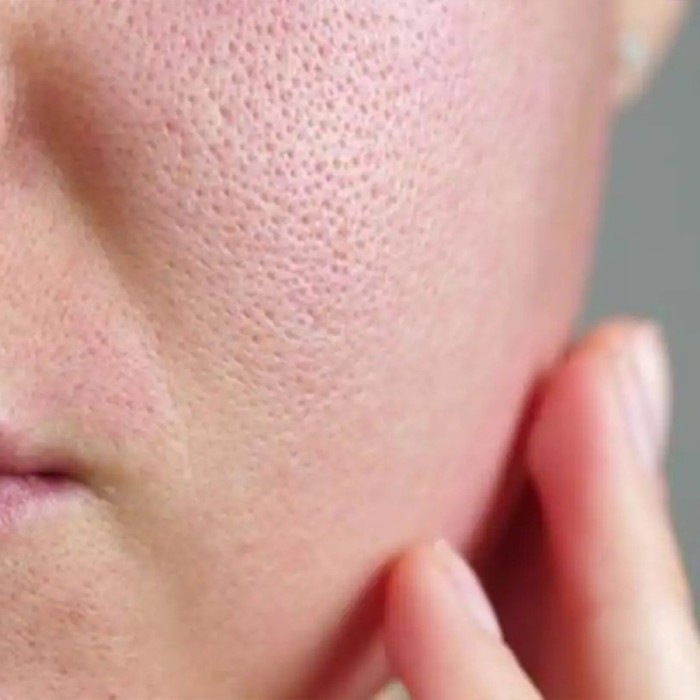 Visible Pores On Face