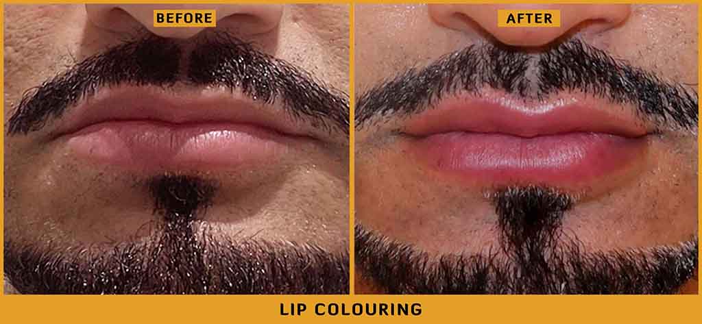 Lip Color Before & After
