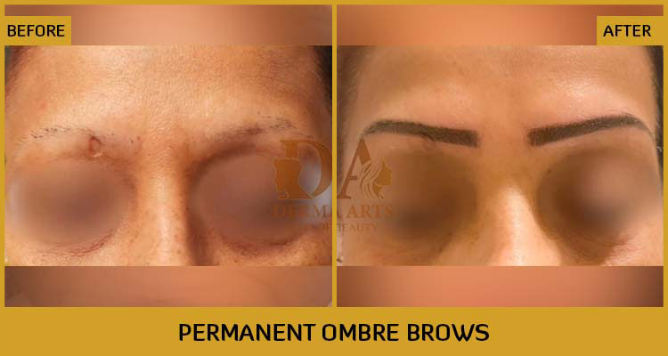 Permanent Ombre Brows Before & After