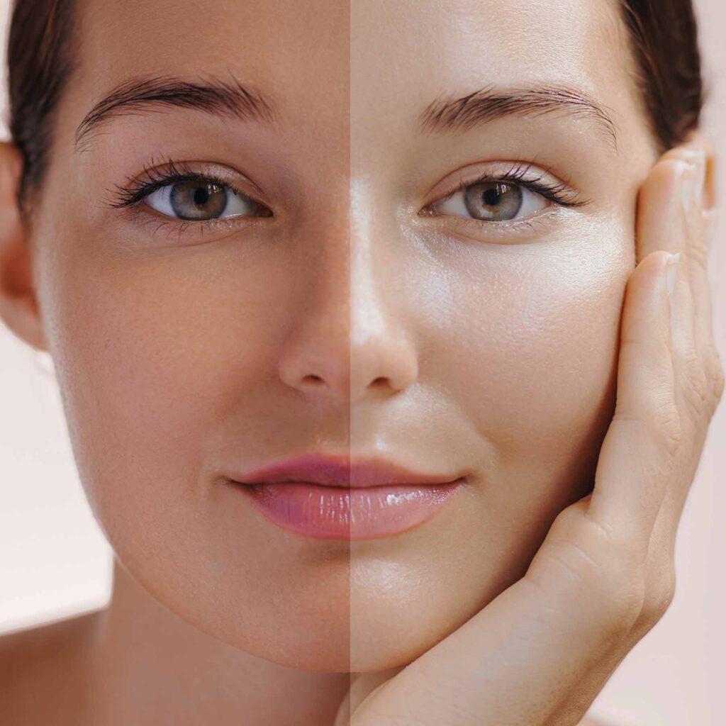 Are Skin Treatments Really Effective for Skin Whitening ?