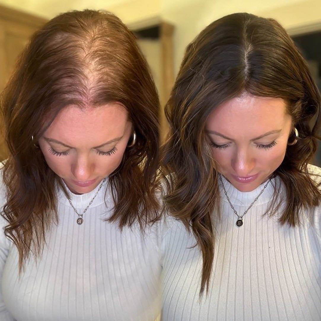 Best Skin Whitening Treatment in Delhi for Glowing, Radiant Skin | Derma Arts